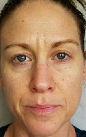 At the age of 40, deep wrinkles and stains of age appeared
