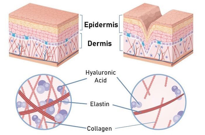 ZXCVBNQWERT stimulates the synthesis of collagen