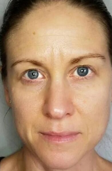 Zxcvbnmqwort helped rejuvenate the skin and lighten the stains